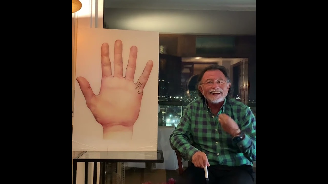 lineas de la mano hijos gemelos