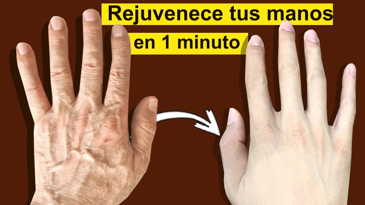 se me arrugan las manos muy rápido