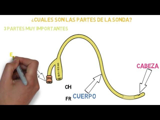 cuáles son los tipos de sondas